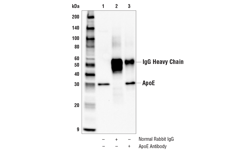 Immunoprecipitation Image 1: ApoE Antibody