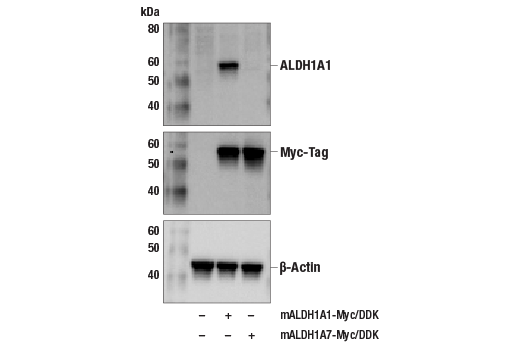 Western Blotting Image 2: ALDH1A1 (D4R9V) Rabbit mAb