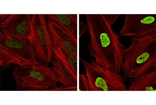 Immunofluorescence Image 1: Acetyl-Histone H3 (Lys9) (C5B11) Rabbit mAb (BSA and Azide Free)