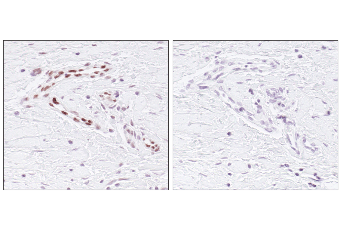 undefined Image 45: ALK Activation Antibody Sampler Kit