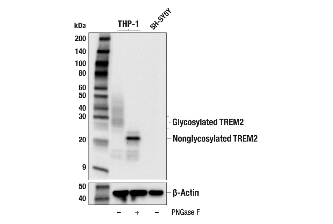 Western Blotting Image 2: TREM2 (E4F5G) Mouse mAb