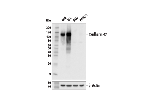 Western Blotting Image 1: Cadherin-17 (E5B1Y) Rabbit mAb