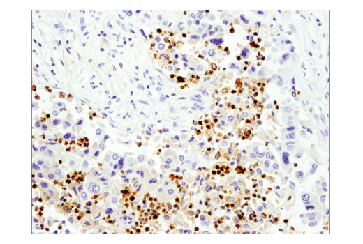 Immunohistochemistry Image 2: Myeloperoxidase (E1E7I) XP<sup>®</sup> Rabbit mAb (BSA and Azide Free)