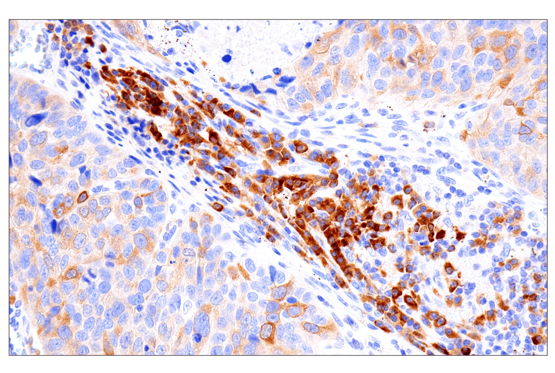 Immunohistochemistry Image 3: Asparagine Synthetase (E6C2C) XP<sup>®</sup> Rabbit mAb (BSA and Azide Free)