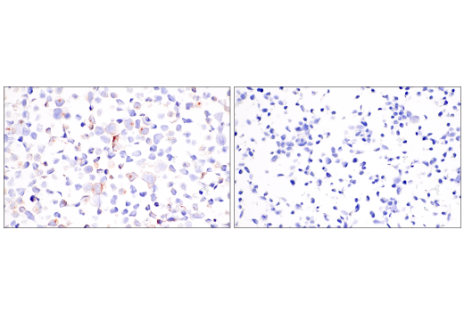 Immunohistochemistry Image 5: CD1A (MTB1) Mouse mAb
