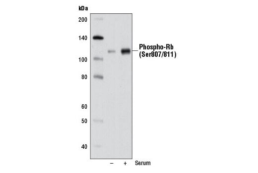 Western Blotting Image 2: Phospho-Rb (Ser807/811) (D20B12) XP<sup>®</sup> Rabbit mAb