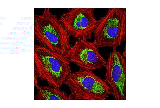 Immunofluorescence Image 1: Anti-rat IgG (H+L), (Alexa Fluor<sup>®</sup> 647 Conjugate)