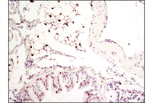 Immunohistochemistry Image 1: C/EBPα (D56F10) XP<sup>®</sup> Rabbit mAb (BSA and Azide Free)