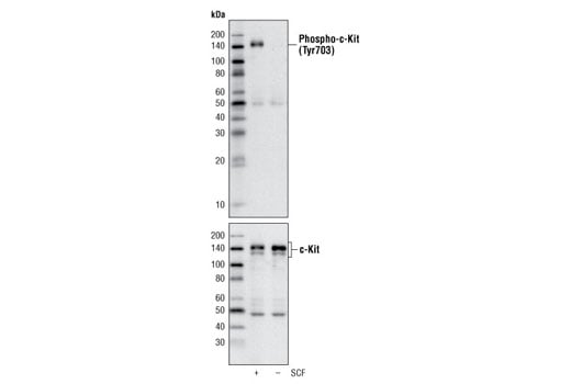 Western Blotting Image 1: Phospho-c-Kit (Tyr703) (D12E12) Rabbit mAb