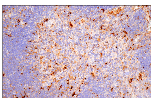 Immunohistochemistry Image 5: Cathepsin D (E7Z4L) XP<sup>®</sup> Rabbit mAb