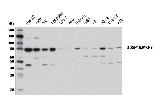 Western Blotting Image 1: DUSP16/MKP7 (D5F4) Rabbit mAb