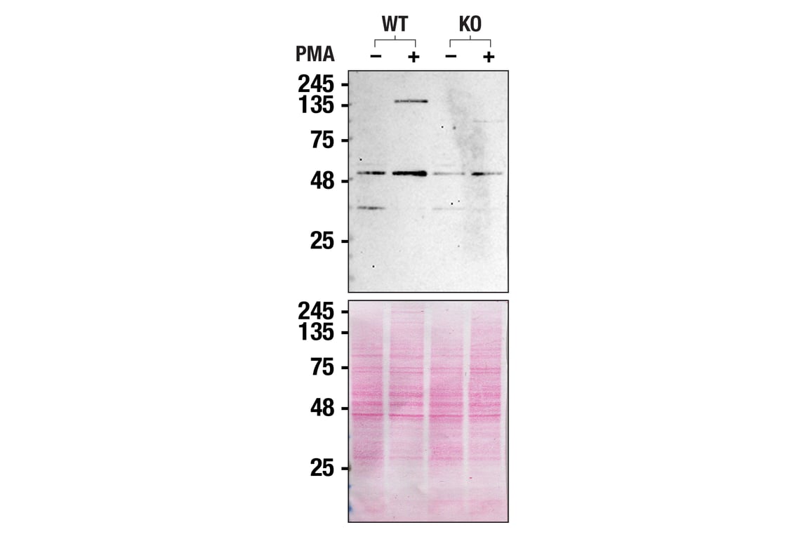 Western Blotting Image 3: PLCγ2 Antibody