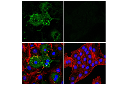 Immunofluorescence Image 1: CD36 (E8B7S) Rabbit mAb