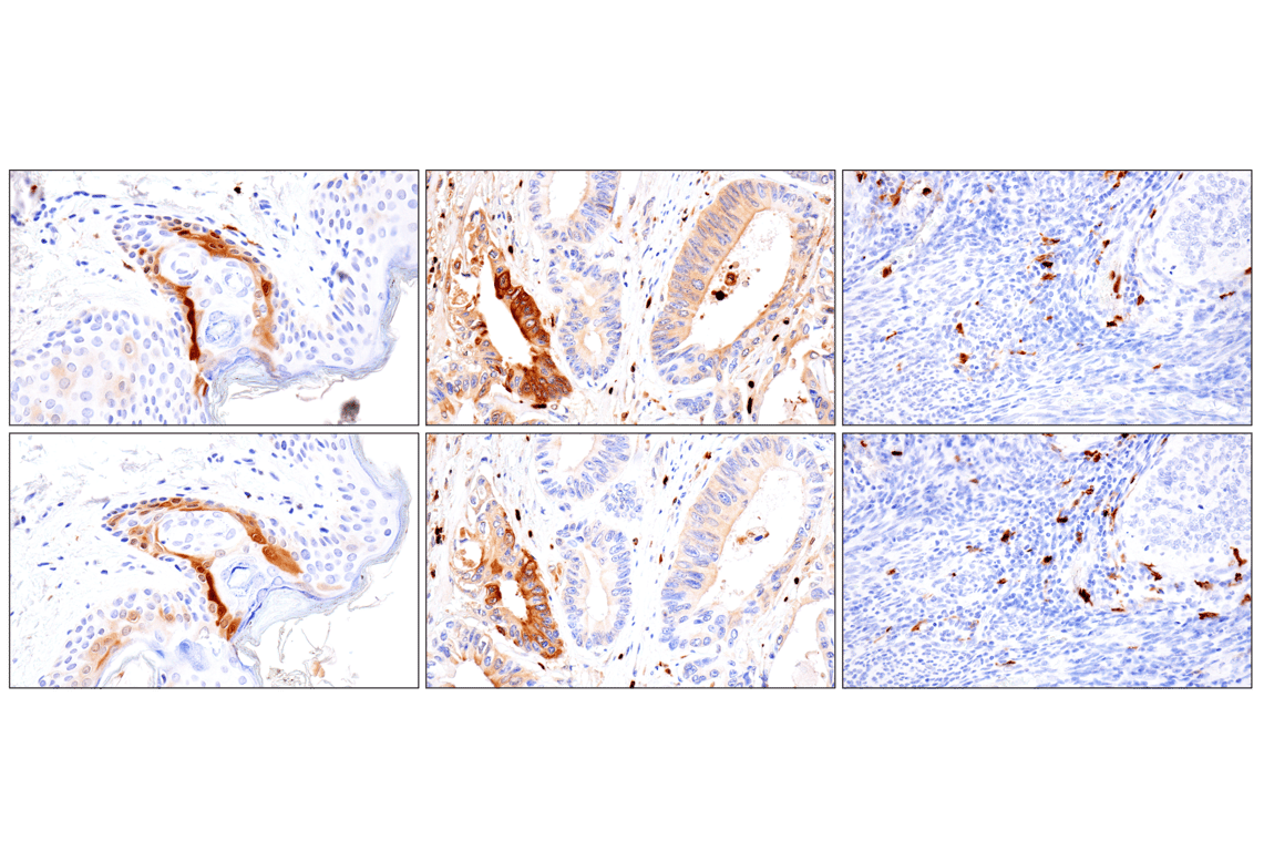 Immunohistochemistry Image 10: S100A8 (F4R2W) Rabbit mAb (BSA and Azide Free)