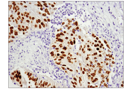 Immunohistochemistry Image 3: Pax6 (D3A9V) XP<sup>®</sup> Rabbit mAb (BSA and Azide Free)