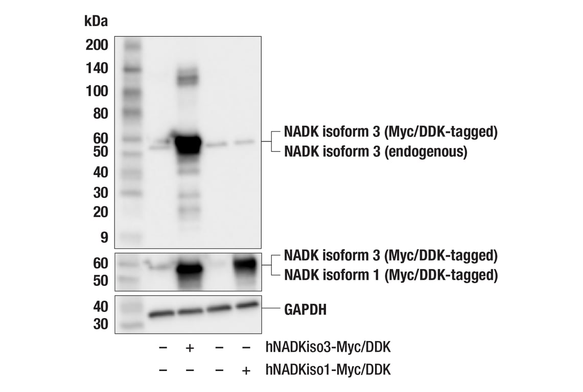 Western Blotting Image 2: NADK Isoform 3 (F5E2T) Rabbit mAb
