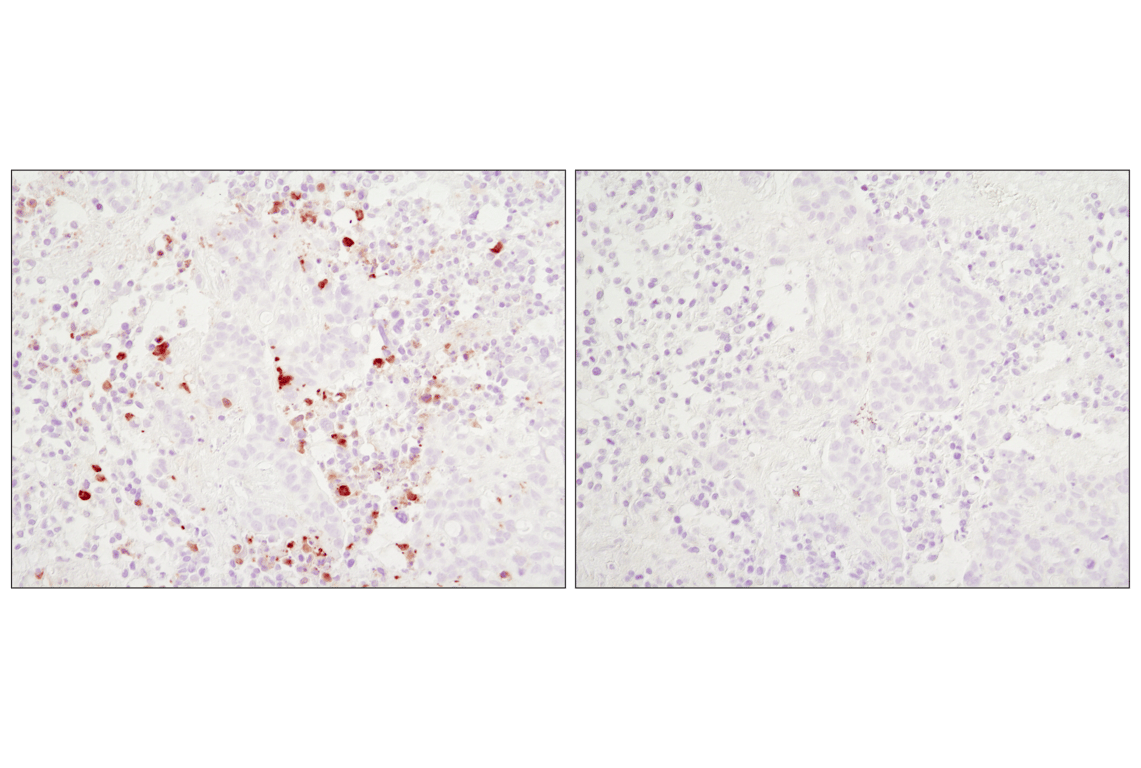 Immunohistochemistry Image 2: Cleaved Caspase-3 (Asp175) (D3E9) Rabbit mAb