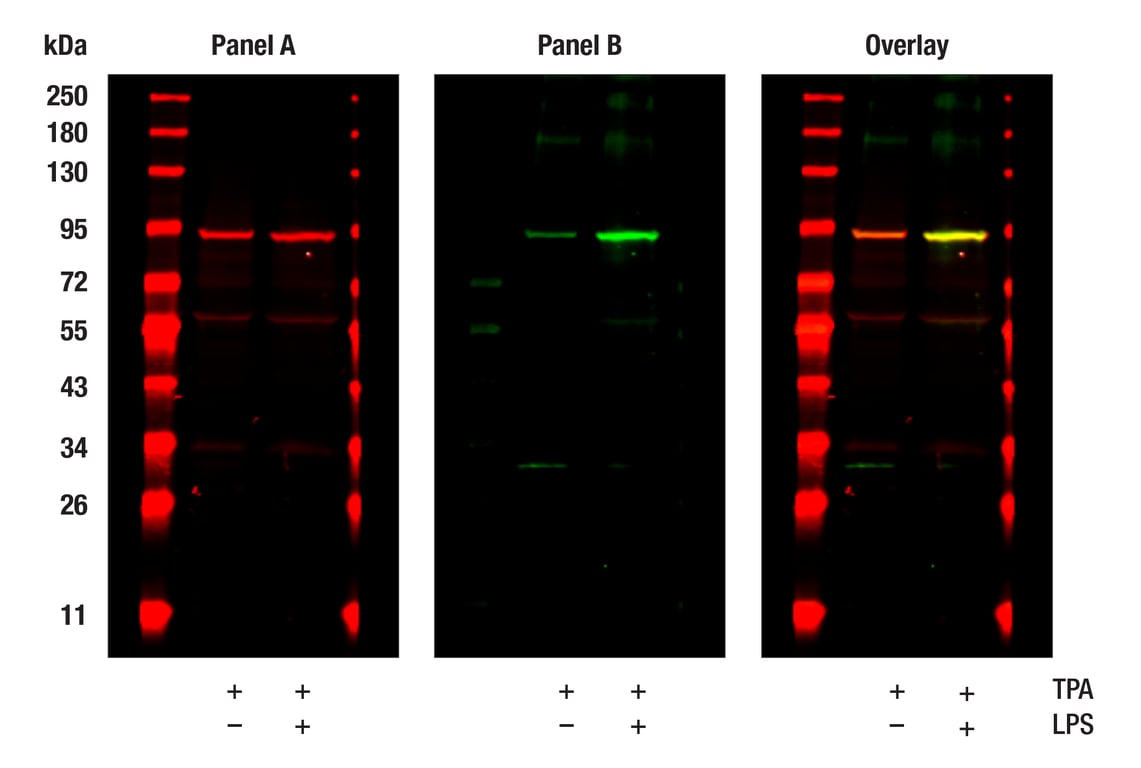 undefined Image 29: Xenophagy Antibody Sampler Kit