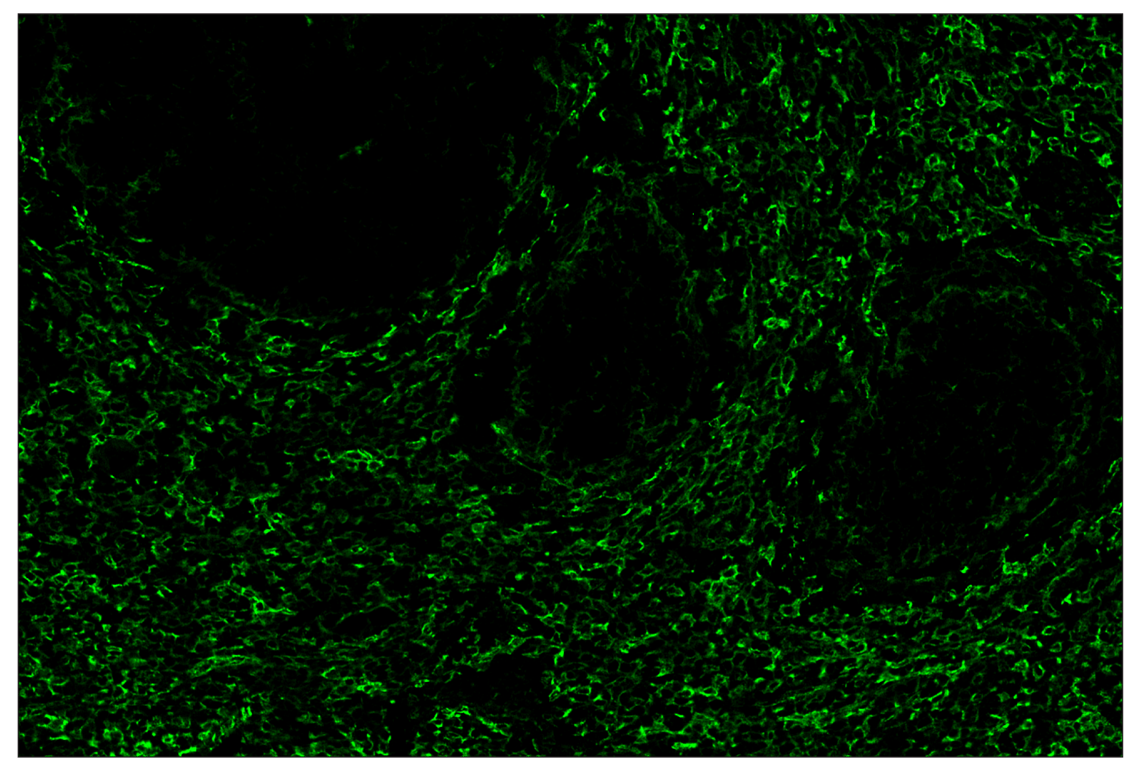 Immunohistochemistry Image 2: CD206/MRC1 (E6T5J) & CO-0032-647 SignalStar<sup>™</sup> Oligo-Antibody Pair