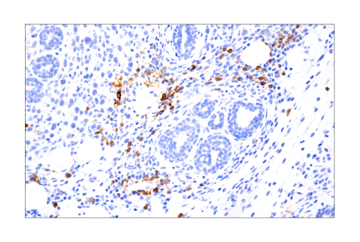 Immunohistochemistry Image 1: IL-2Rα/CD25 (E9W2J) XP<sup>®</sup> Rabbit mAb