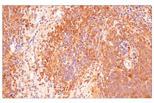 Immunohistochemistry Image 10: p70 S6 Kinase (E8K6T) XP<sup>®</sup> Rabbit mAb