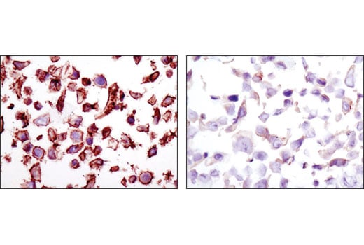 undefined Image 68: Lung Cancer RTK Antibody Sampler Kit