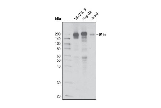 Western Blotting Image 1: Mer (D21F11) XP<sup>®</sup> Rabbit mAb