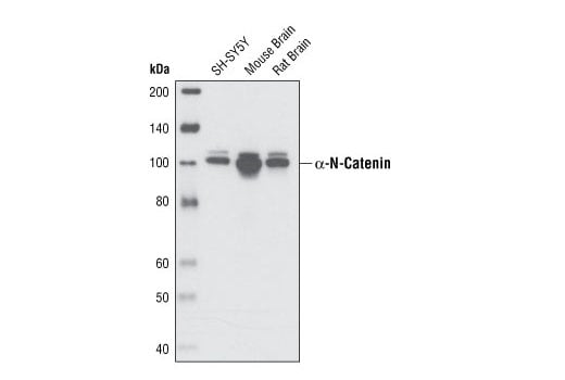 Western Blotting Image 1: α-N-Catenin (C12G4) Rabbit mAb
