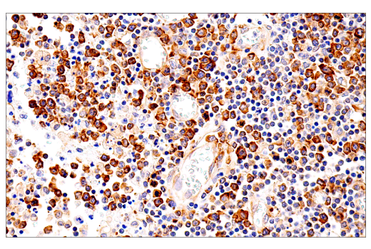 Immunohistochemistry Image 10: G3BP1 (E9G1M) XP<sup>®</sup> Rabbit mAb