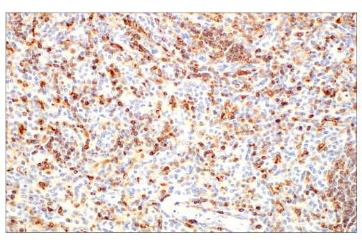 Immunohistochemistry Image 4: CD74 (D5N3I) XP<sup>®</sup> Rabbit mAb (BSA and Azide Free)