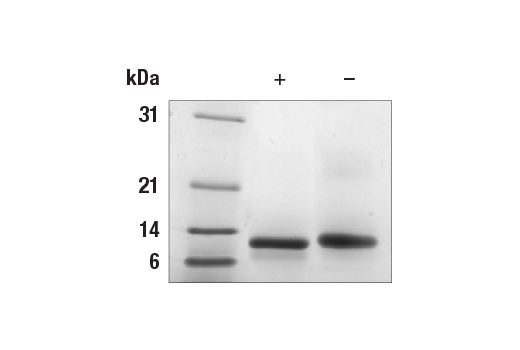 Human CTGF Recombinant Protein: Image 1