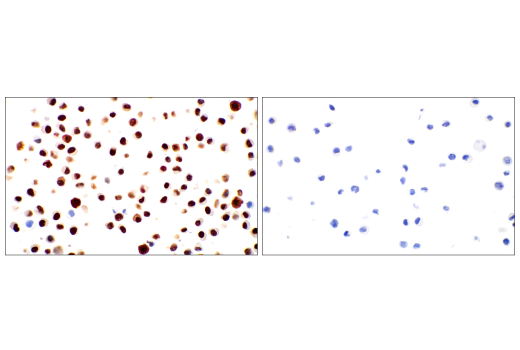 Immunohistochemistry Image 10: MAGE-C2/CT10 (E7B8D) XP<sup>®</sup> Rabbit mAb