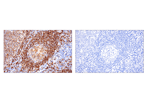 Immunohistochemistry Image 2: CD22 (E7L6Z) XP<sup>®</sup> Rabbit mAb (BSA and Azide Free)