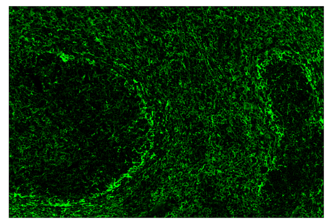 Immunohistochemistry Image 2: CD86 (E5W6H) & CO-0051-750 SignalStar<sup>™</sup> Oligo-Antibody Pair