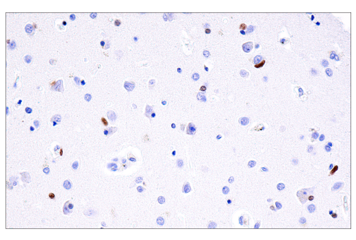 Immunohistochemistry Image 2: Olig2 (E6G6Q) XP<sup>®</sup> Rabbit mAb (BSA and Azide Free)