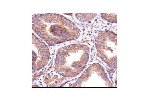 Immunohistochemistry Image 2: IGF-I Receptor β Antibody