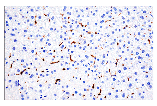 Immunohistochemistry Image 4: CD68 (E3O7V) Rabbit mAb