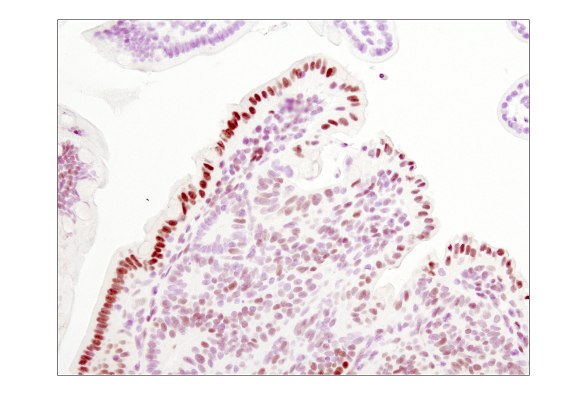 undefined Image 38: ALK Activation Antibody Sampler Kit