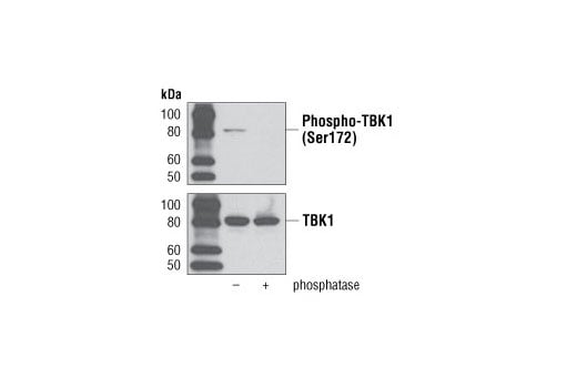 undefined Image 20: Xenophagy Antibody Sampler Kit