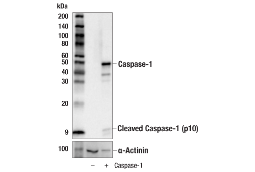 Western Blotting Image 2: Caspase-1 (E9R2D) Rabbit mAb