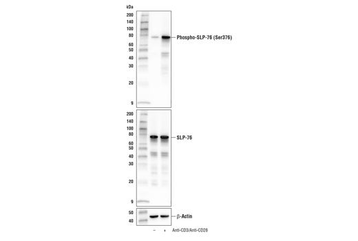 Western Blotting Image 2: Phospho-SLP-76 (Ser376) (E3G9U) XP<sup>®</sup> Rabbit mAb