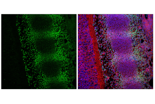 undefined Image 72: Epithelial-Mesenchymal Transition (EMT) IF Antibody Sampler Kit