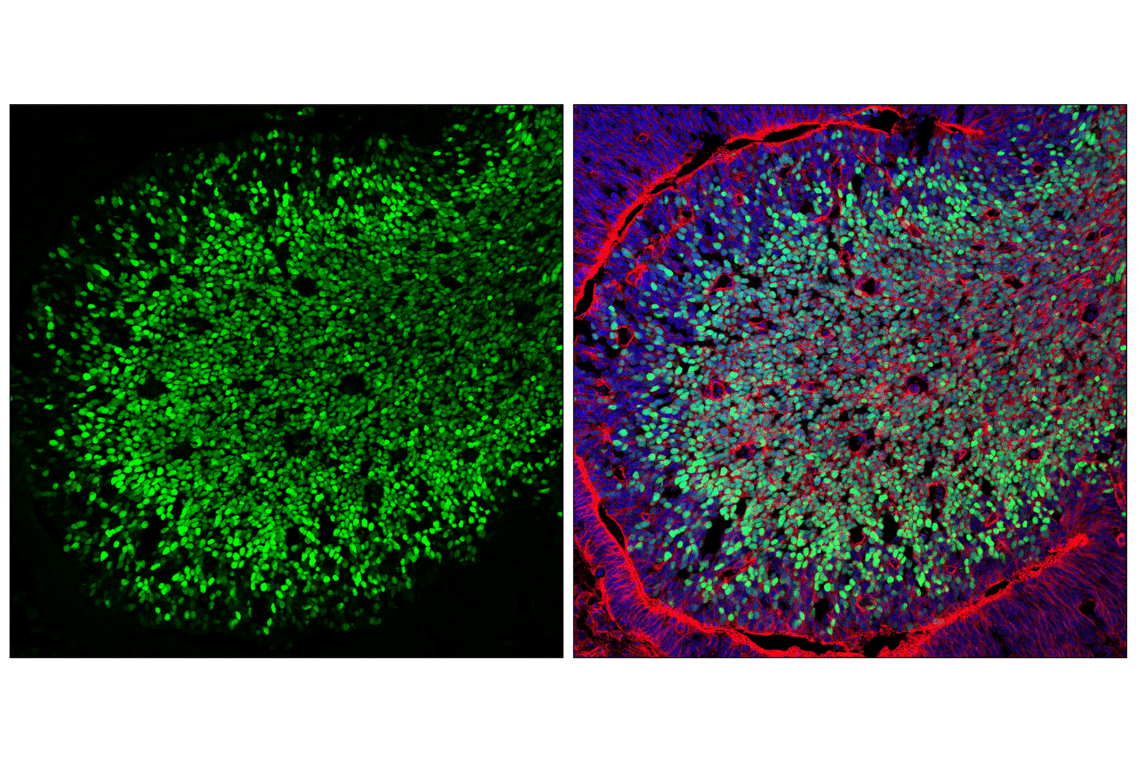 Immunofluorescence Image 1: DLX1 (E4T1L) Rabbit mAb