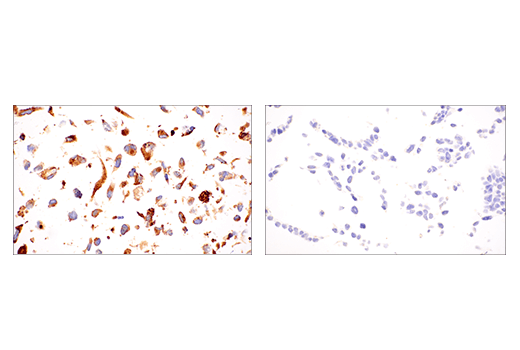 Immunohistochemistry Image 2: LOXL2 (E3P7Y) Rabbit mAb (BSA and Azide Free)