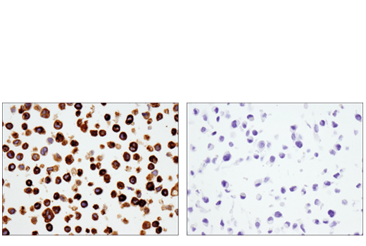 Immunohistochemistry Image 4: YKL-40 (E2L1M) Rabbit mAb