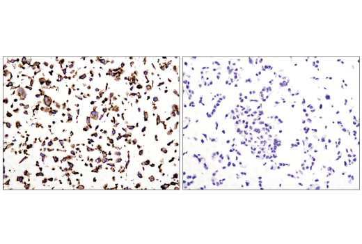 Immunohistochemistry Image 3: N-Cadherin (D4R1H) XP<sup>®</sup> Rabbit mAb (BSA and Azide Free)