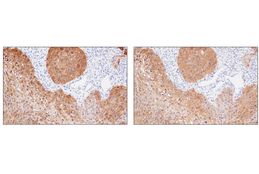 Immunohistochemistry Image 3: MAGE-A4 (E7O1U) XP<sup>®</sup> Rabbit mAb (BSA and Azide Free)