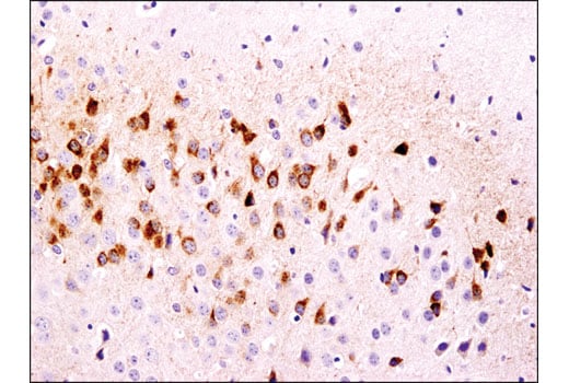 Immunohistochemistry Image 2: CART (D6M2M) Rabbit mAb