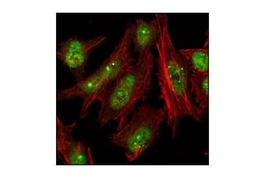 Immunofluorescence Image 1: 53BP1 Antibody