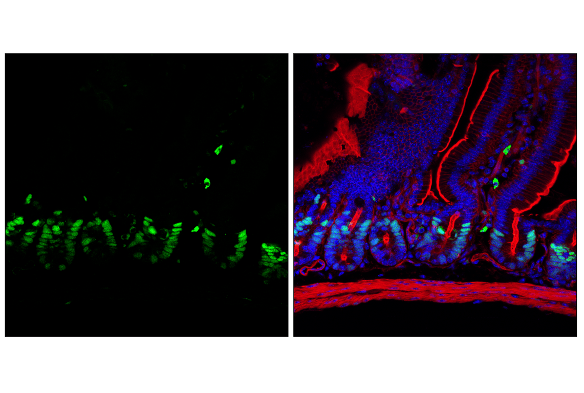 Immunofluorescence Image 1: Phospho-Rb (Ser807/811) (D20B12) XP<sup>®</sup> Rabbit mAb